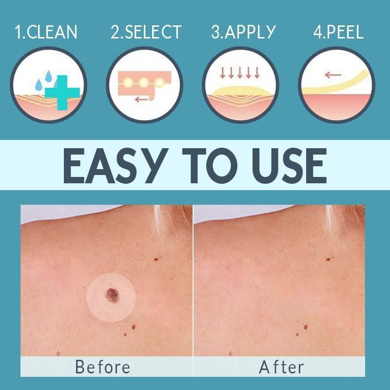 Skin Tag Remover Patch